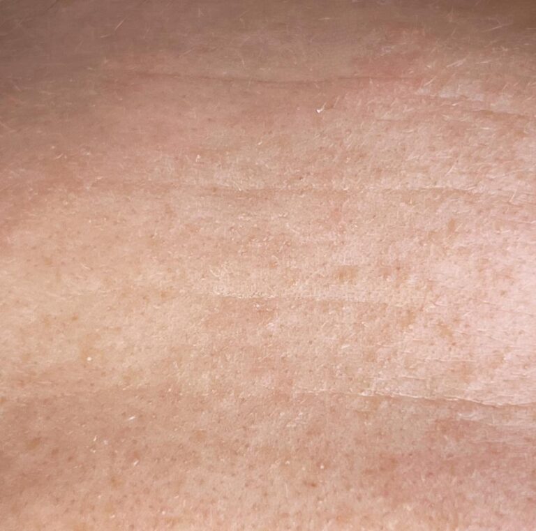 Nahaufnahme von Stirnfalten eines empfindlichen Hautbildes