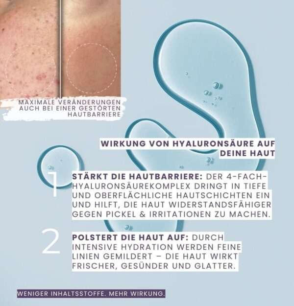 Hyaluronsäure stärkt die Hautbarriere, mildert Falten & beruhigt irritierte Haut – Velvetbooster Wirkung